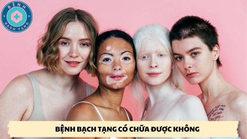 bệnh bạch tạng có chữa được không