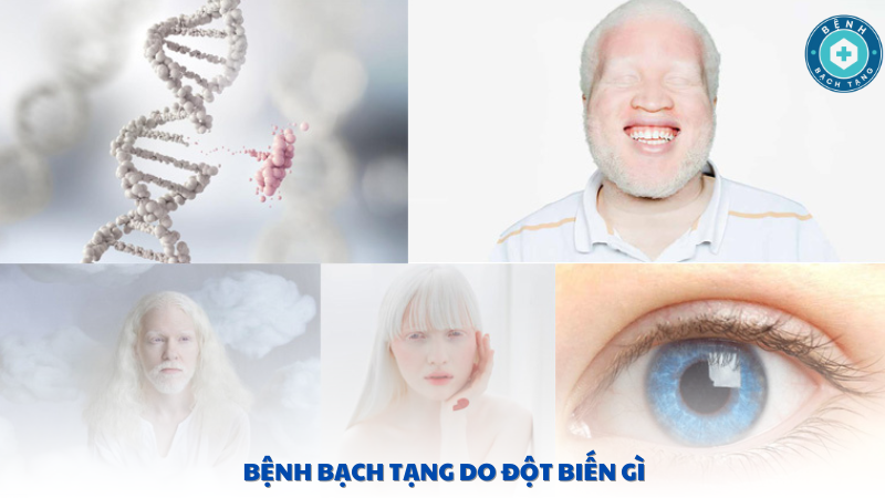 bệnh bạch tạng do đột biến gì