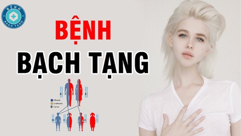 dấu hiệu của bệnh bạch tạng